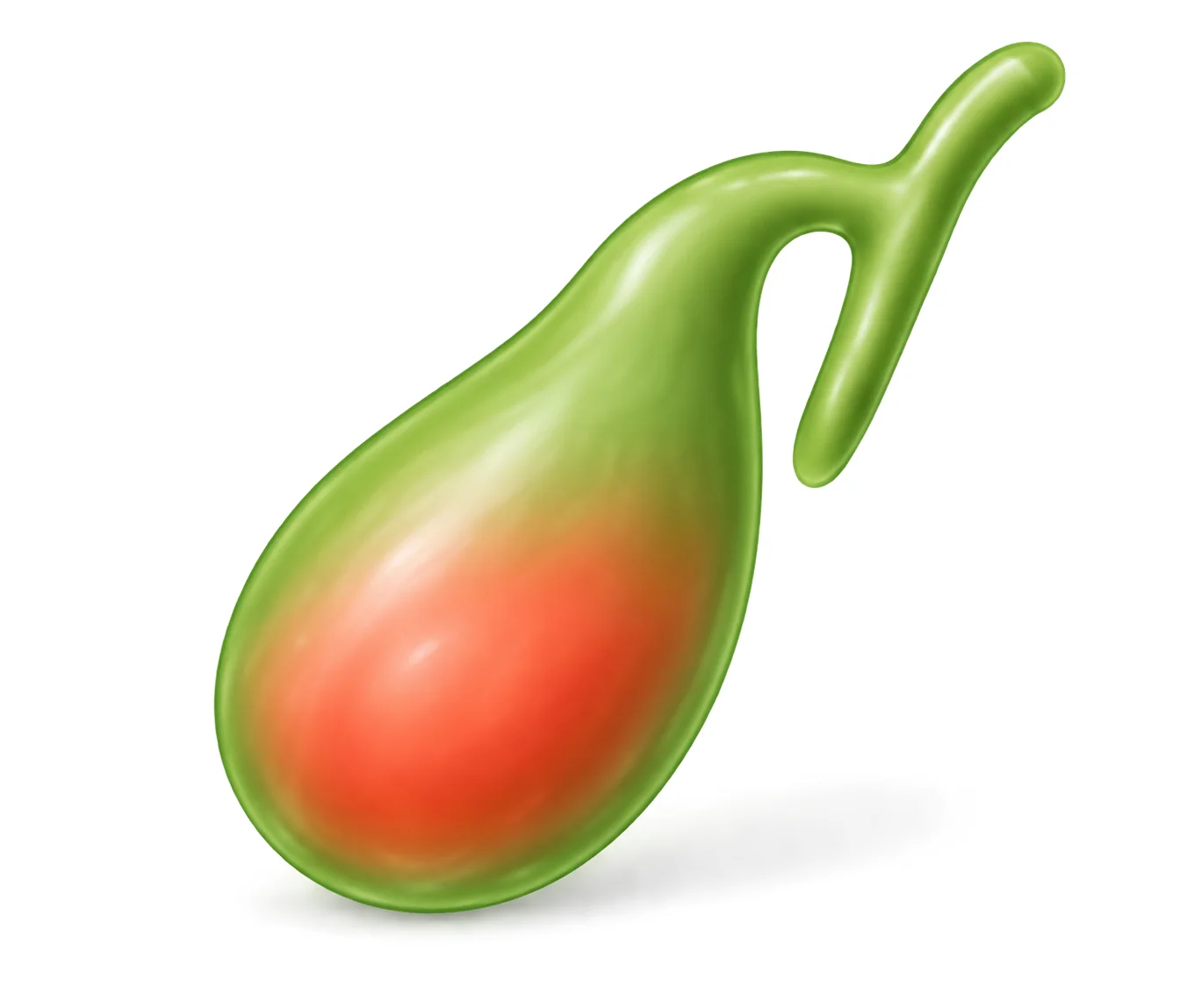 Illustration of a gallbladder with a red, inflamed area.