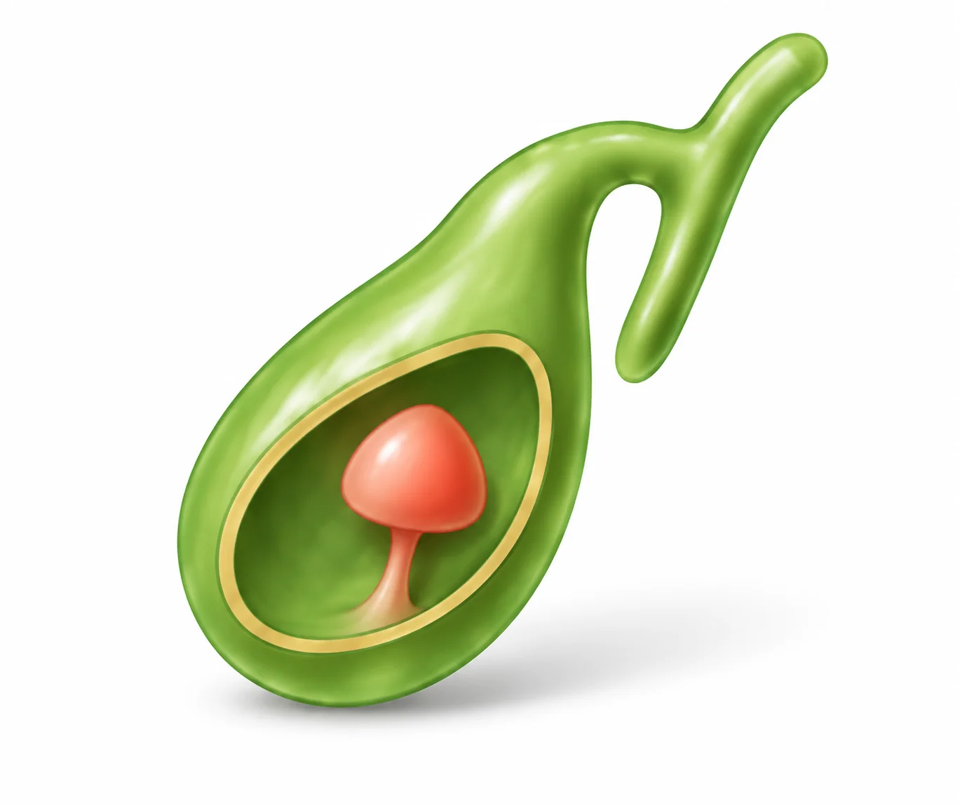 Cutaway illustration of a mushroom-shaped polyp growing on a stalk from the gallbladder wall.